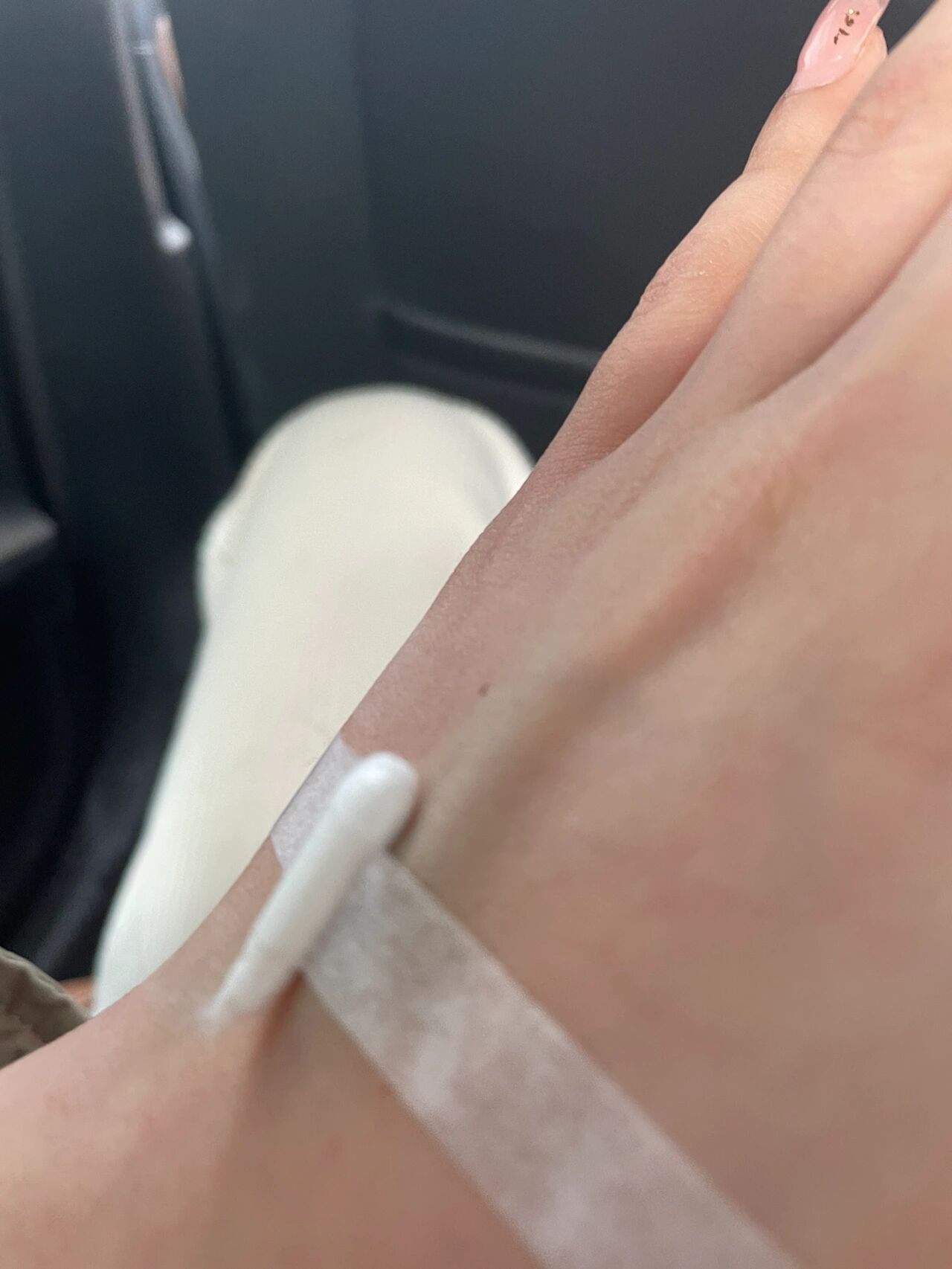 因为感冒引起的头痛 今天第二天输液,医生拔针后血管就成这样了,硬得