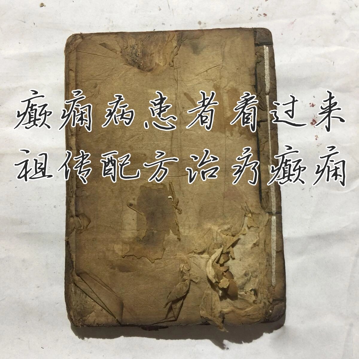 祖传癫痫秘方,无论你是抽搐翻白眼,还是失神叫不应.都有解决配方