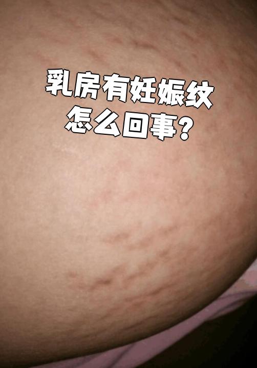 怀孕期间体内雌激素,孕激素水平升高,会导致乳房组织快速生长