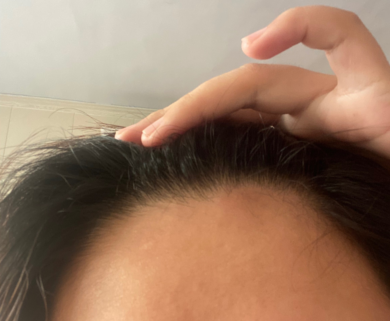 额头上起了一个特别硬的疙瘩不疼不痒 有没有姐妹知道的 昨天晚上在