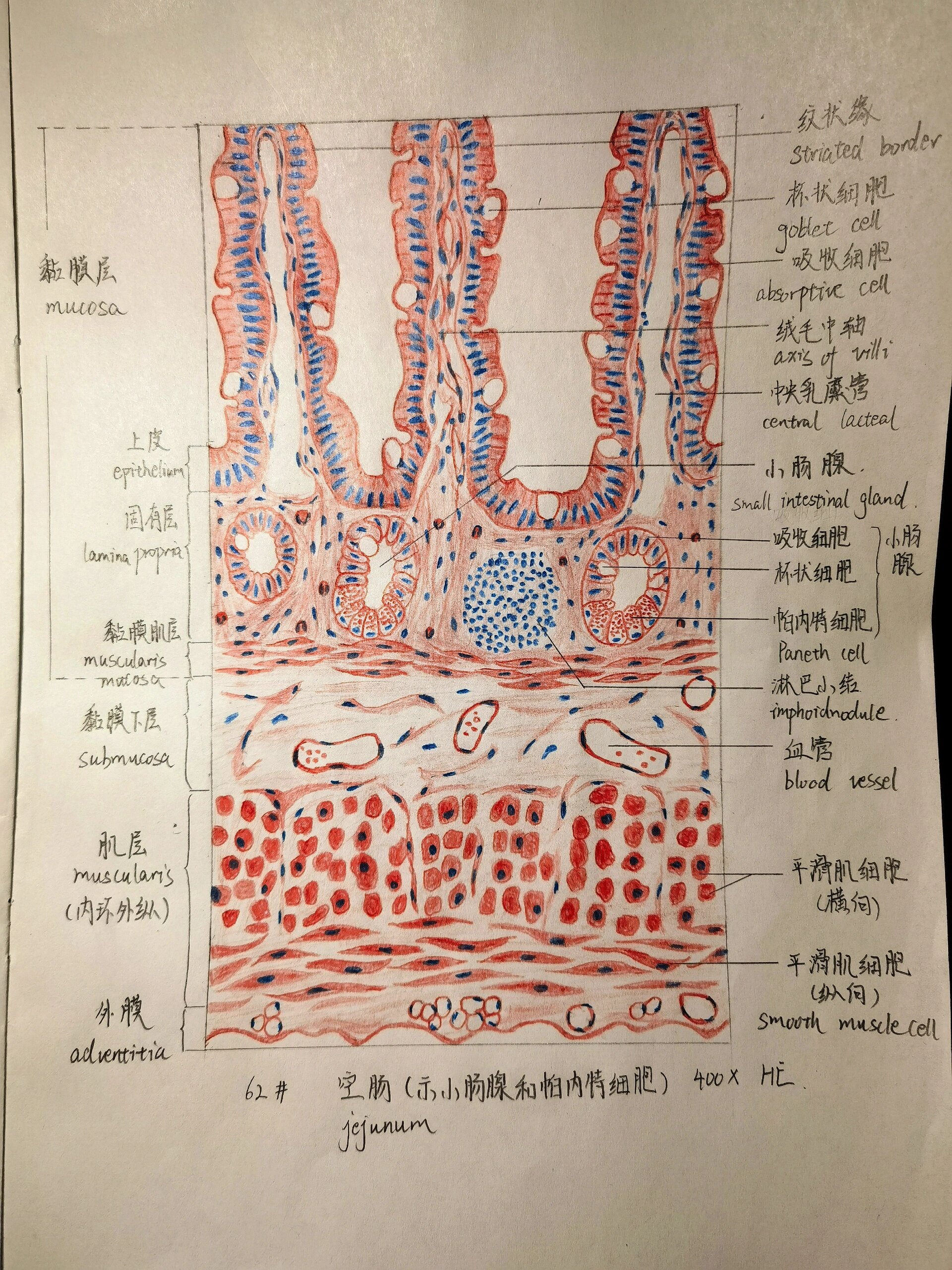 肠结核红蓝铅笔图图片