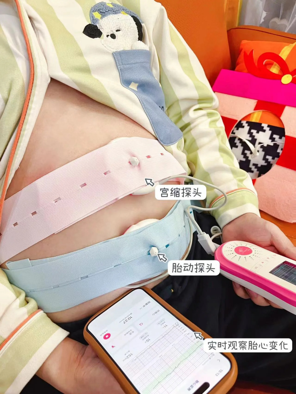 听劝,不建议买胎心监护仪7575 孕晚期的话租一台胎心监护仪就可以