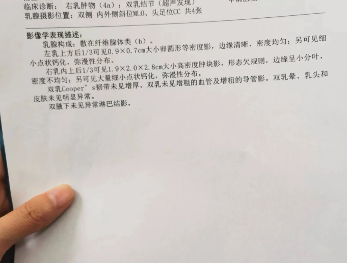 乳腺钼靶检查的作用是什么