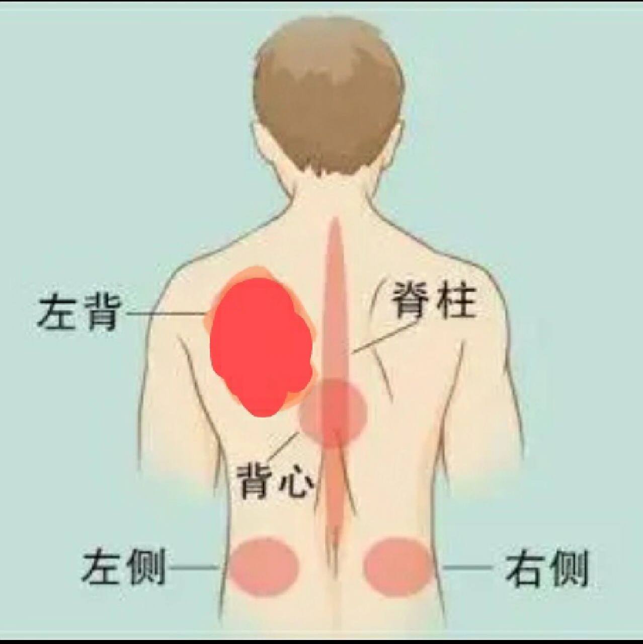 左肩胛骨(后背疼) 昨天一早起床还没什么感觉上了个大号回来,想躺下