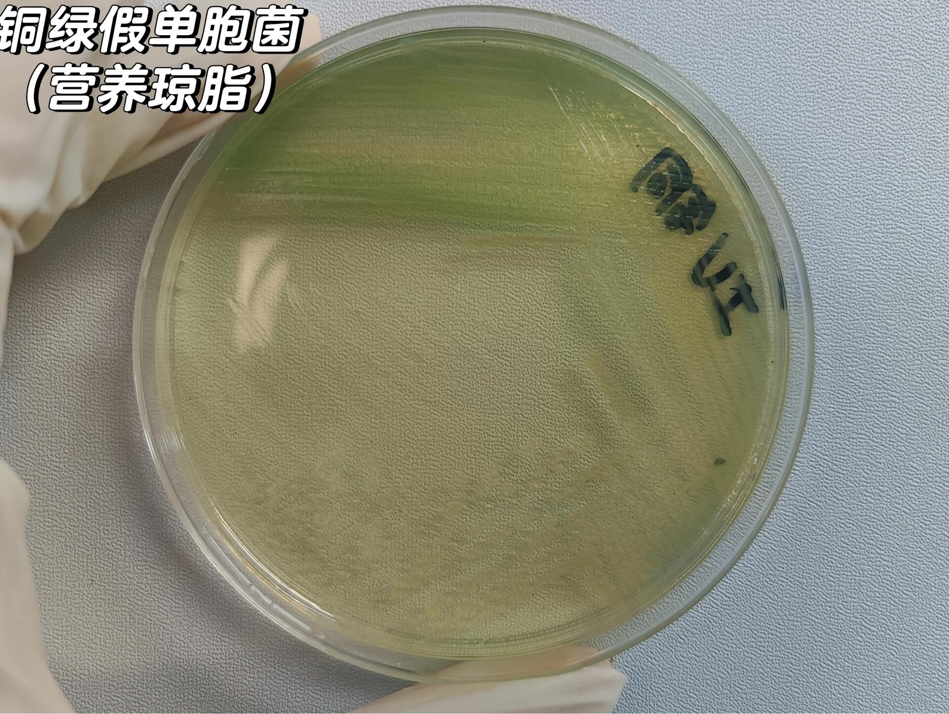 铜绿假单胞菌,黄杆菌