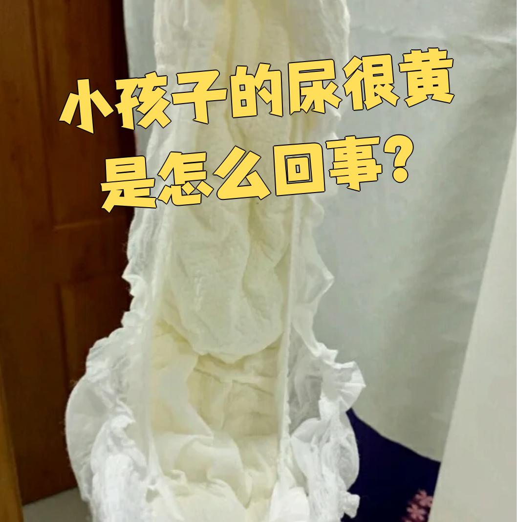 尿液为什么是黄色