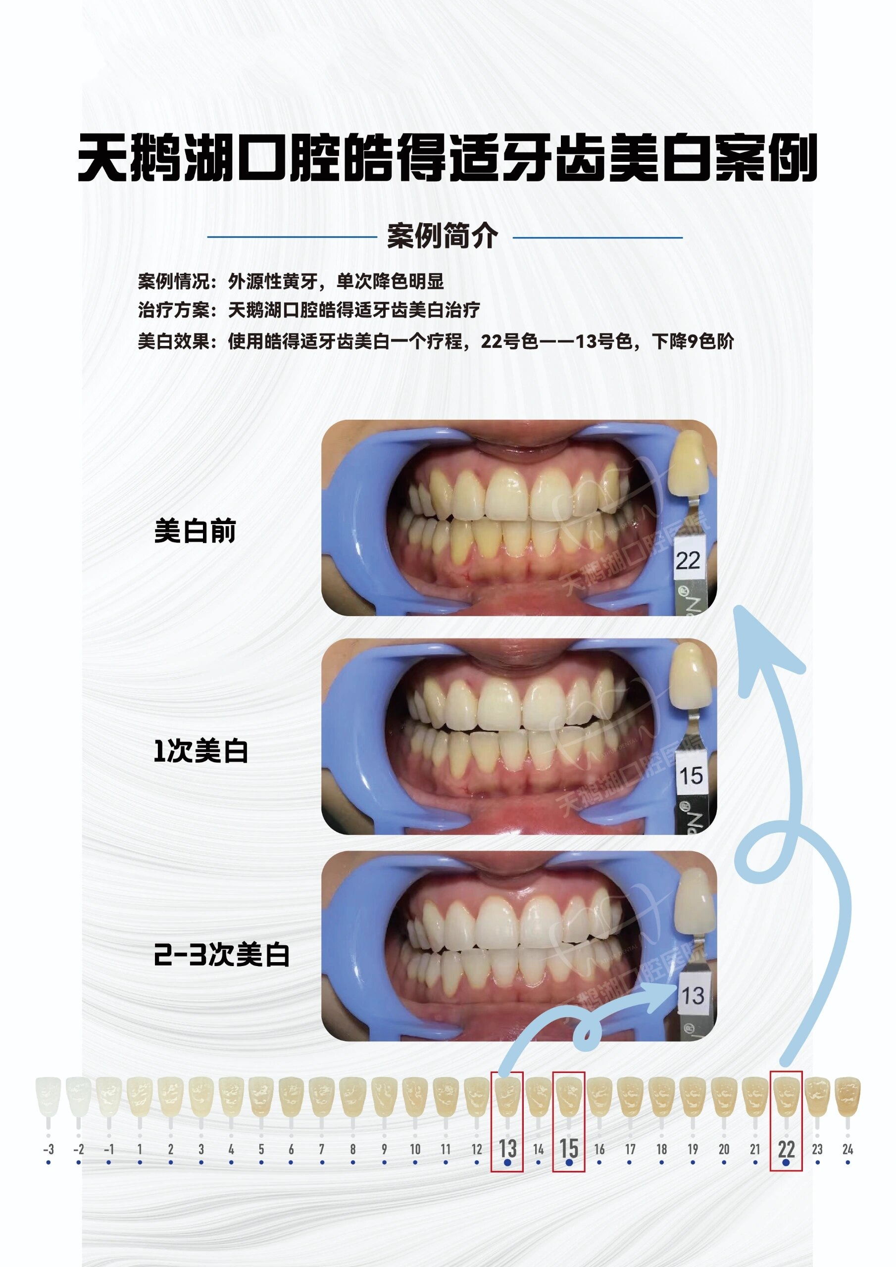 牙齿07美白 090909首选皓得适 很多爱美的女孩子,都有07不