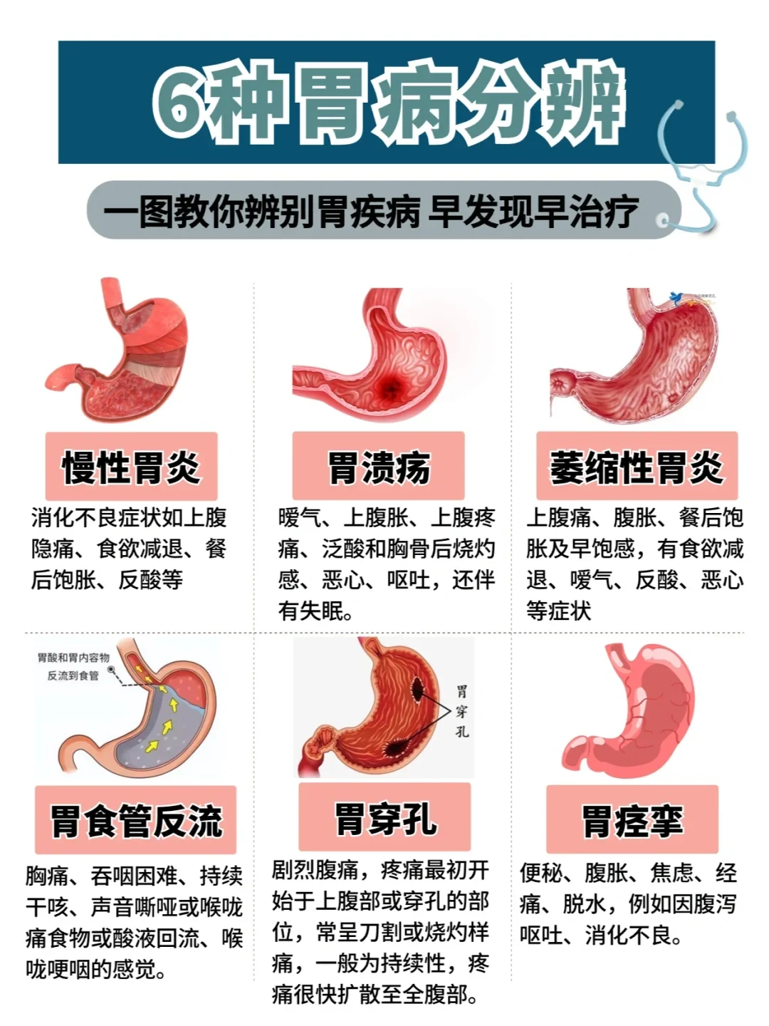 教你辨别胃疾病 91慢性胃炎 消化不良症状如上腹隐痛