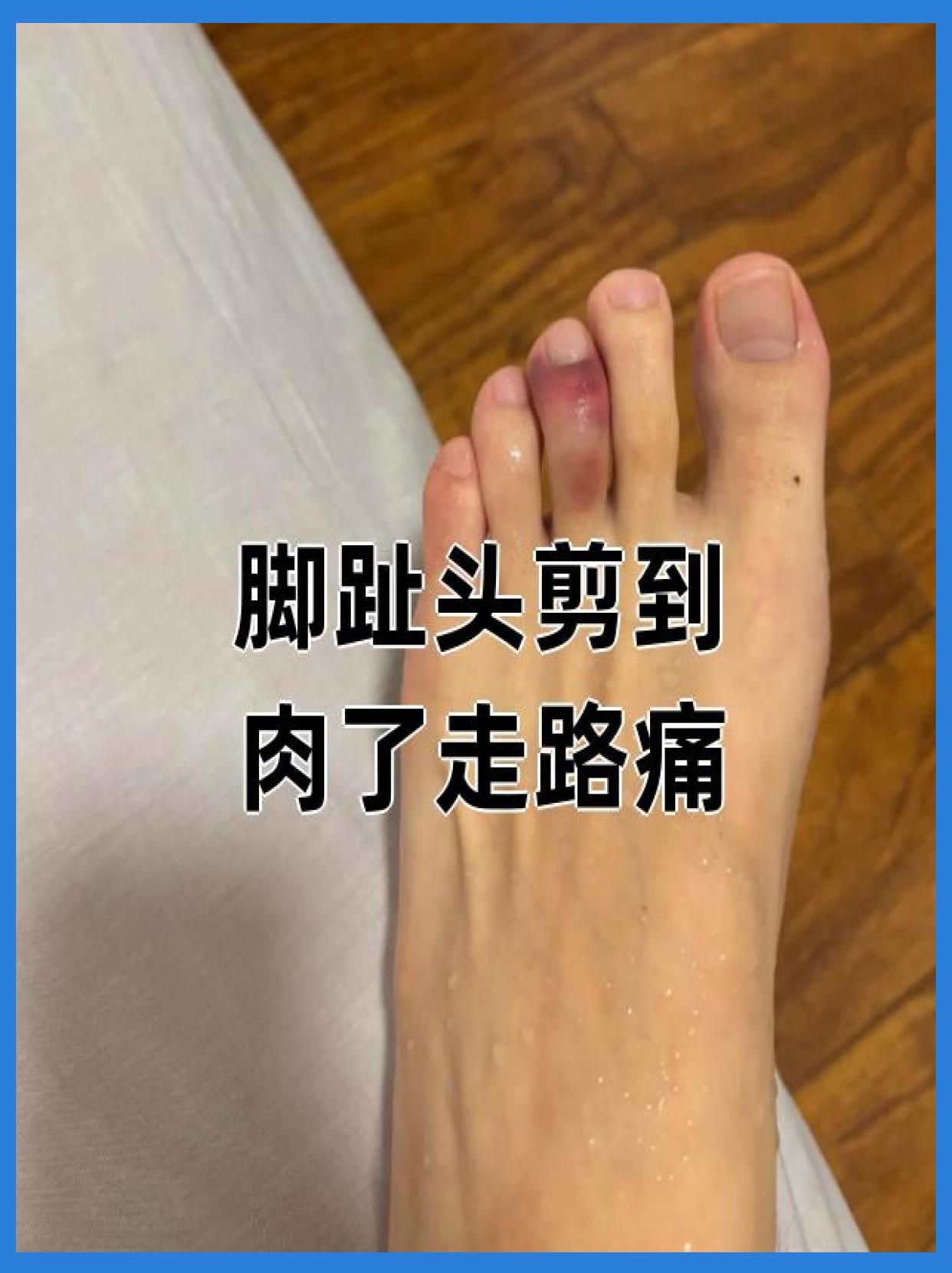 包含安定医院预约检查陪诊挂号术后伤口观察提醒，减少感染风险的词条