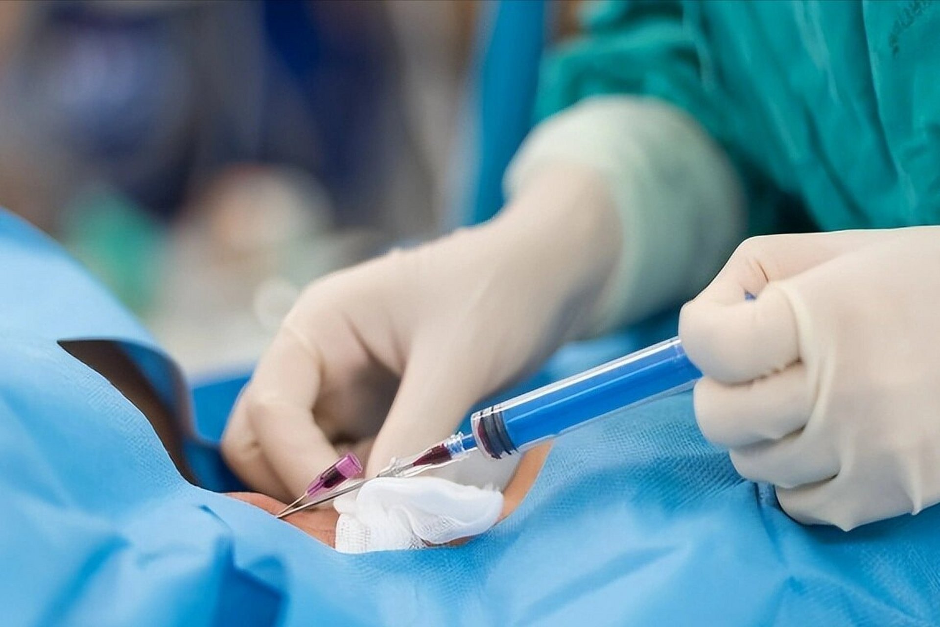 很多人不知道为什么要给乳房做穿刺,就这么解释吧～ 一个月饼单看外