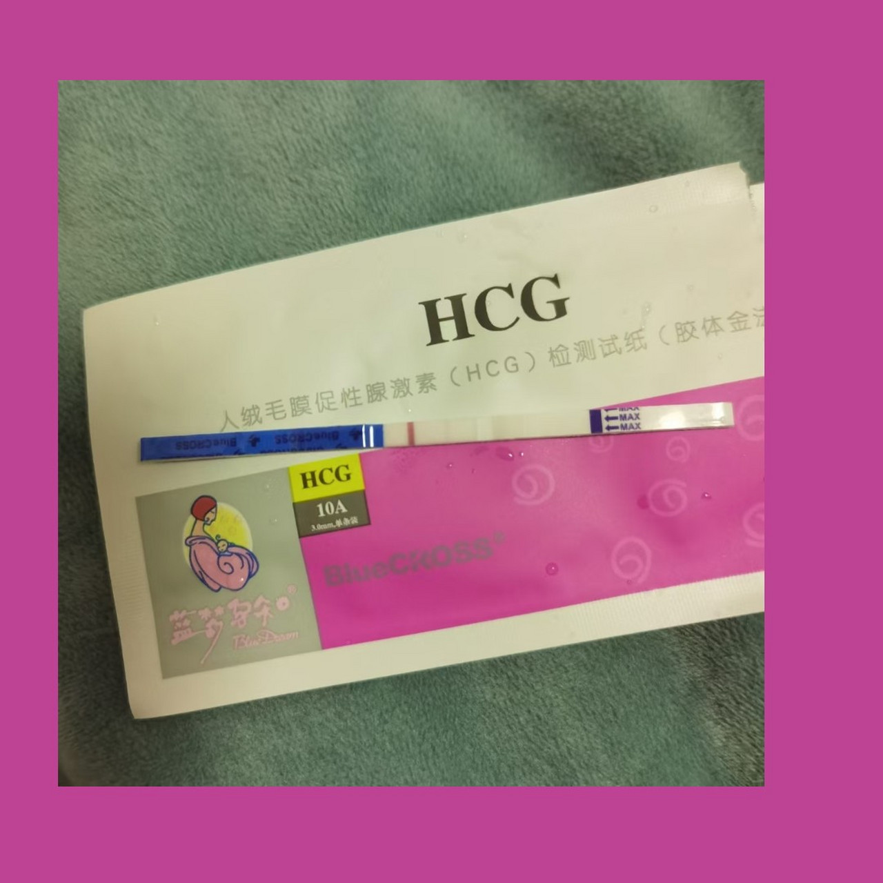 什么是hcg hcg全称为人绒毛膜促性腺激素,只存在于孕妇的体内,由胎盘