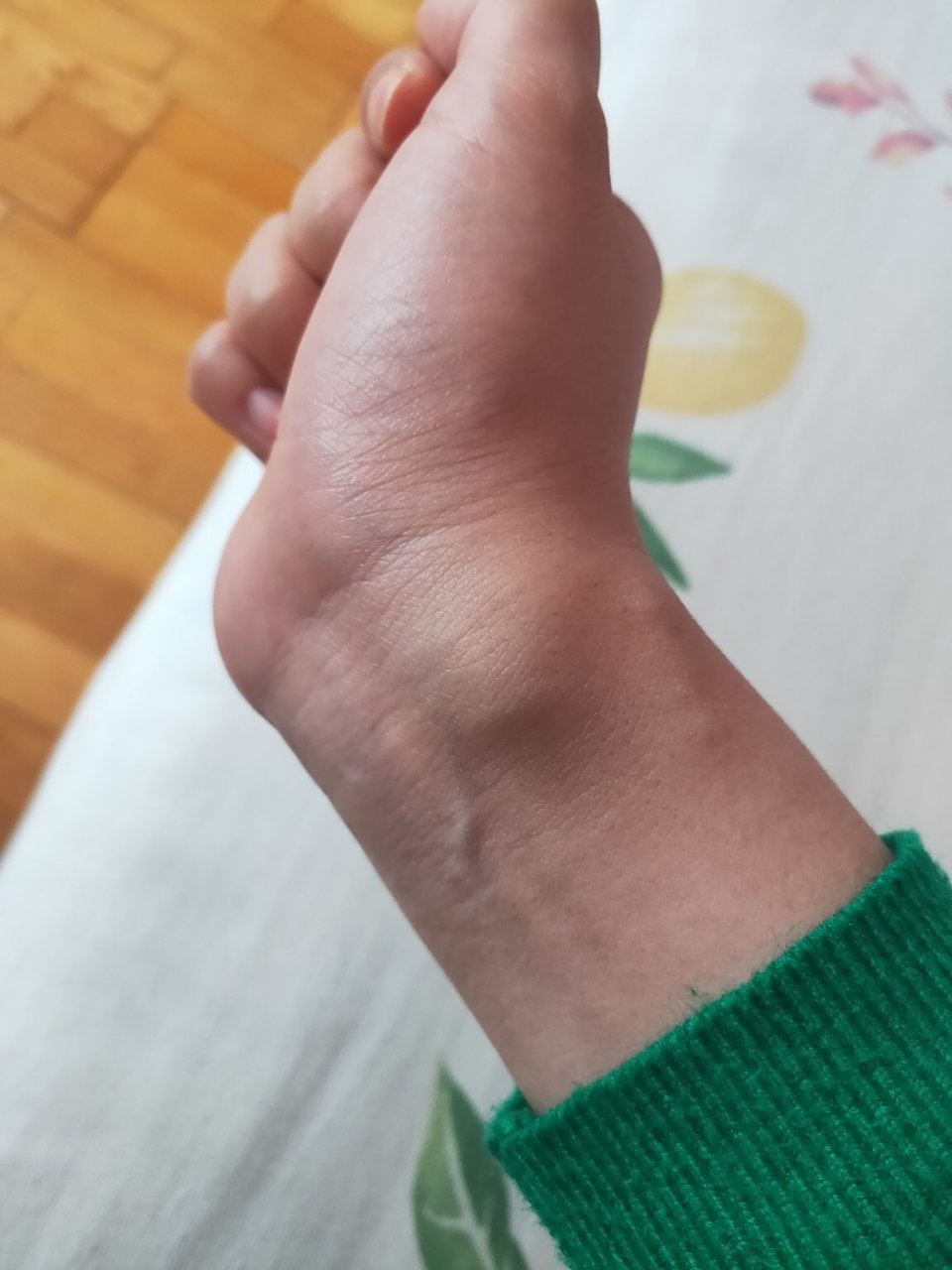 年初发现了,后来问中医说是腱鞘囊肿不用管,我也没再管,但是手腕不能