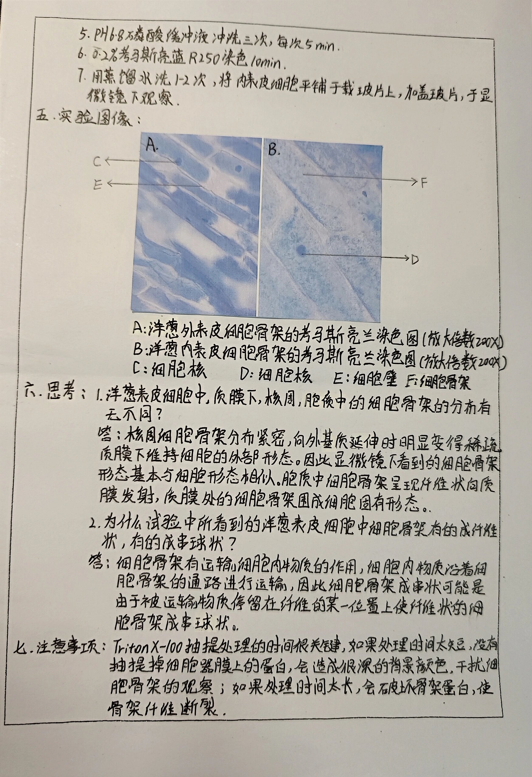 植物细胞骨架手绘图图片