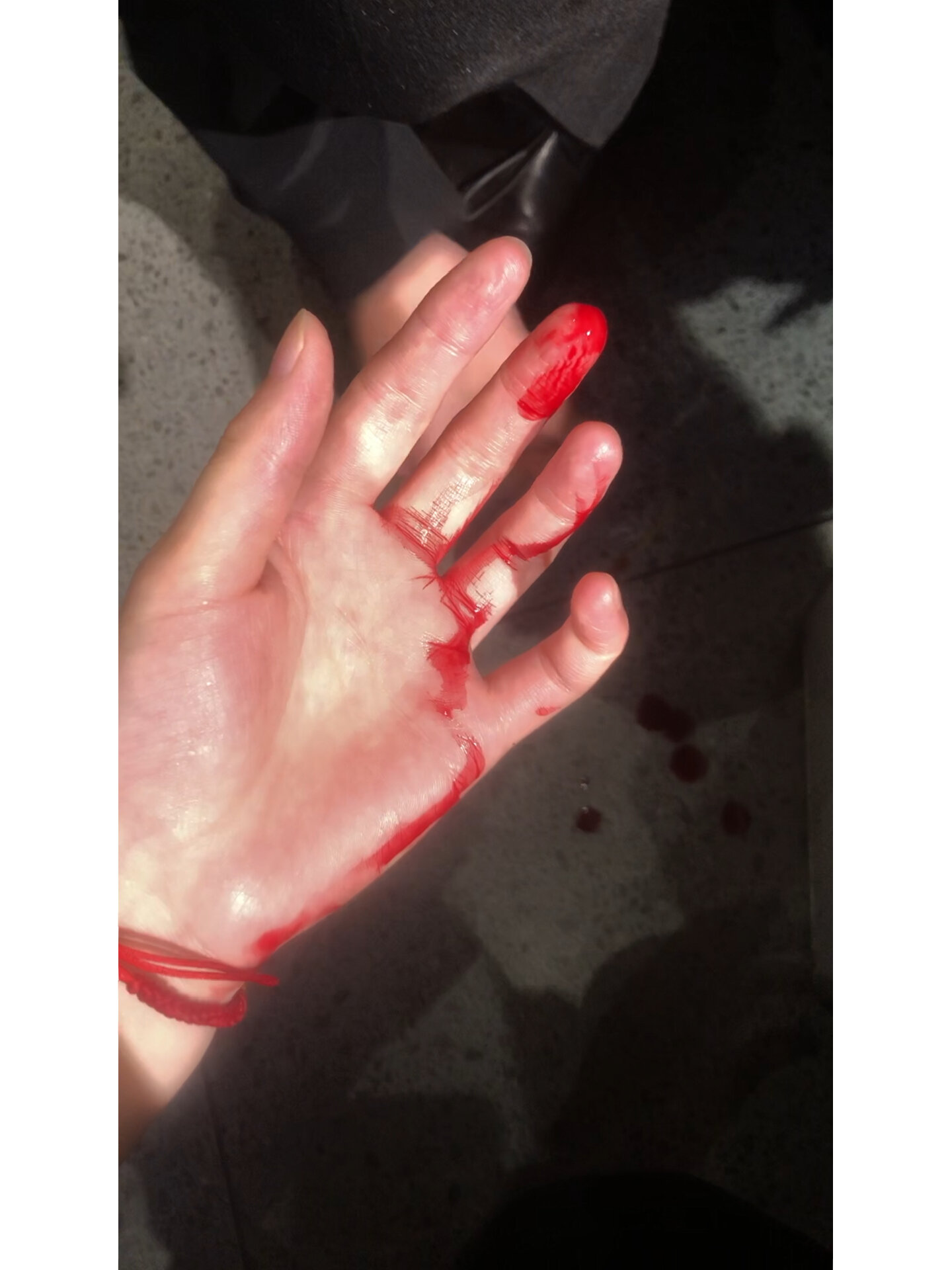 手指受伤 你们都是怎么洗澡的