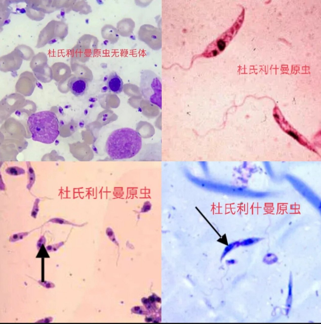 鞭毛红蓝铅笔图图片