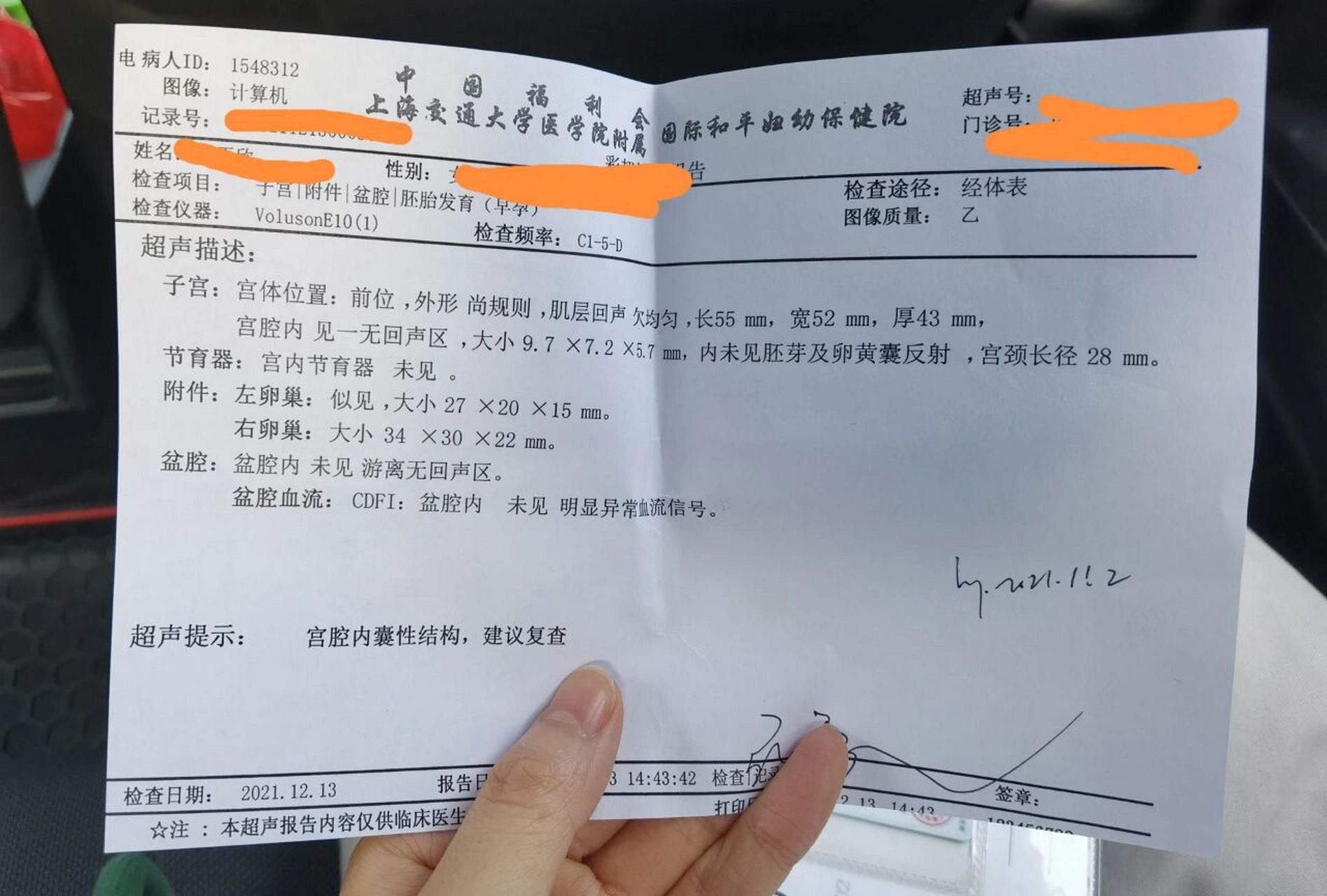 一超,停经41天看到了孕囊 宝宝迎来了第一次b超.