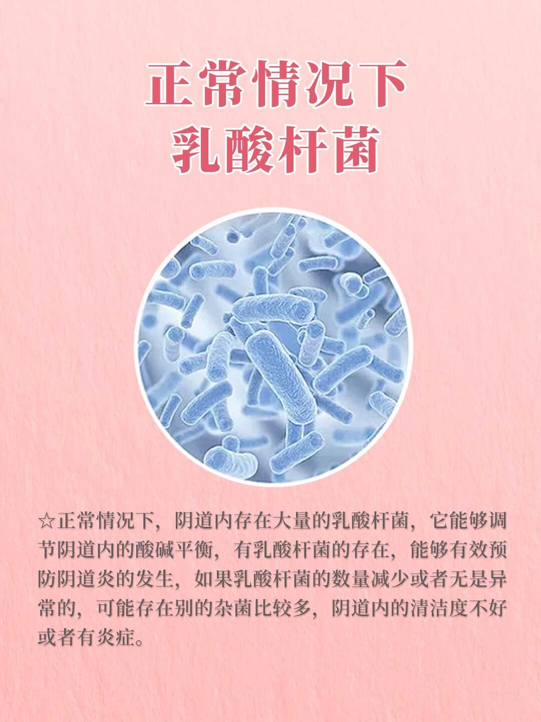 白带检查乳酸杆菌少或无 姐妹们,平时我们去做白带常