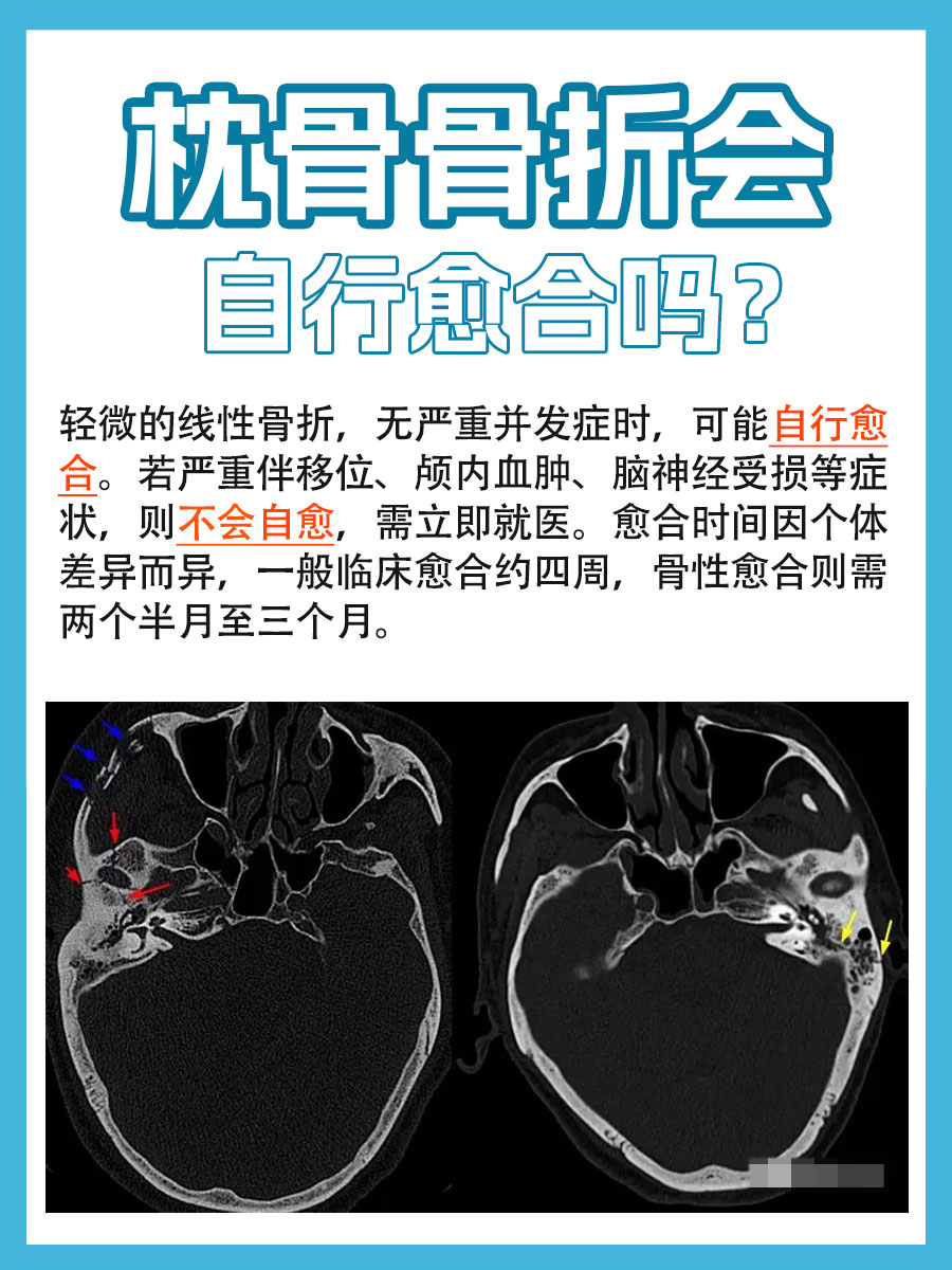 枕骨大孔骨折图片