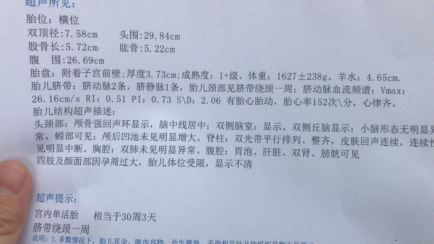 孕30周去复查4维,医生说我胎位不正.横位绕颈一周.集美们.