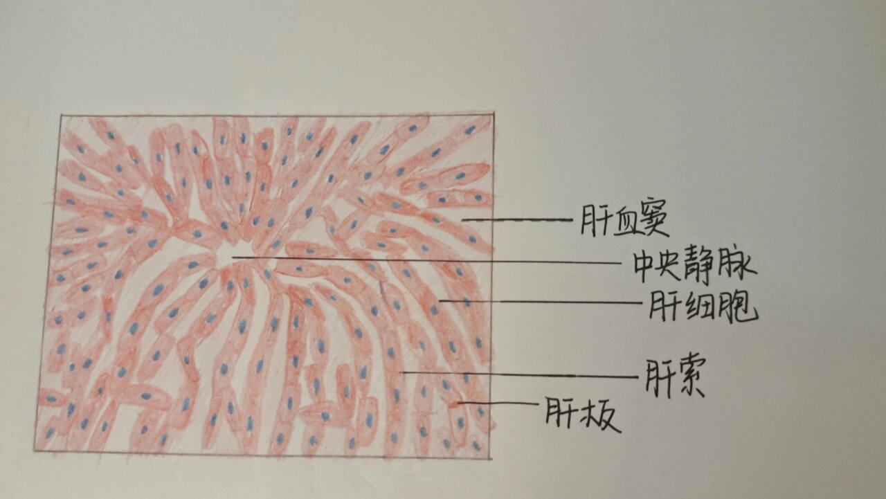 肝脏假小叶图片