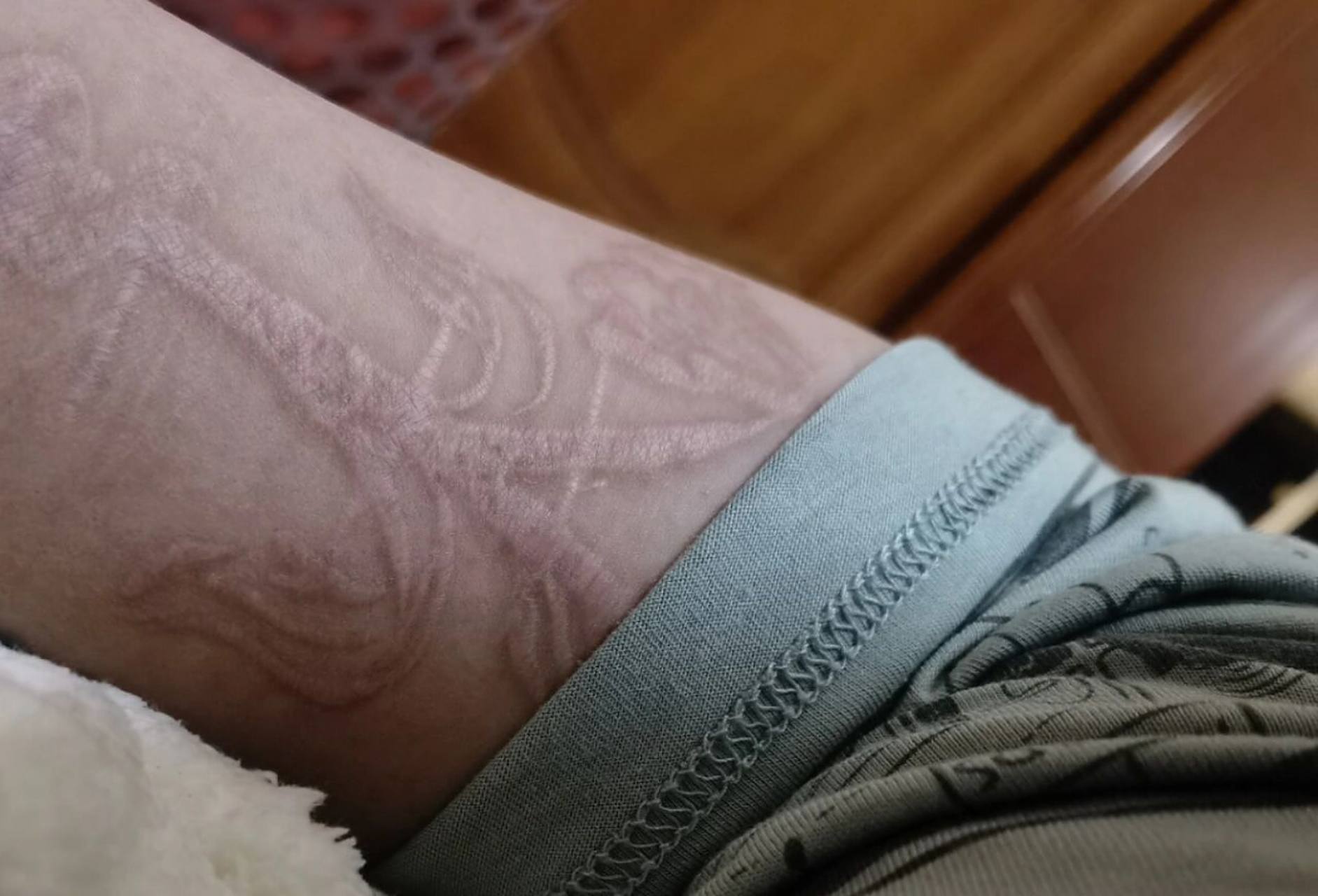 割皮/纹身00 十个月后,来自小爱