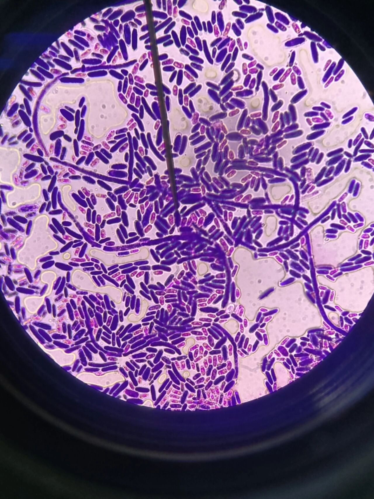 念珠菌家族🌈🌈🌈 接上篇,是各个念珠菌革兰染色后的镜下形态