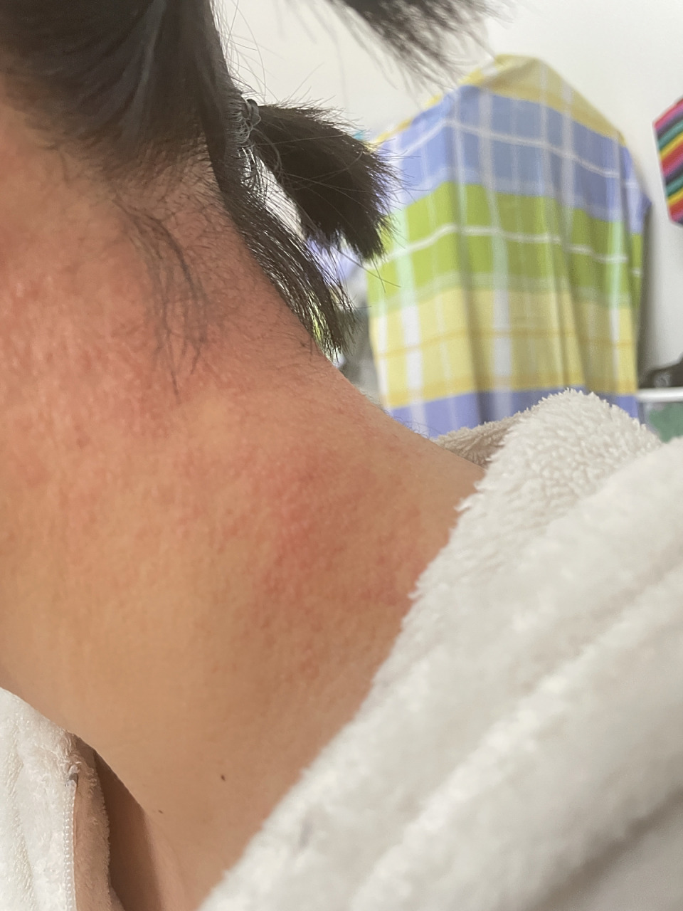 脖子红肿粗糙痒 好像是过敏性皮炎,上周明明好了,今天又开始了,痒的不