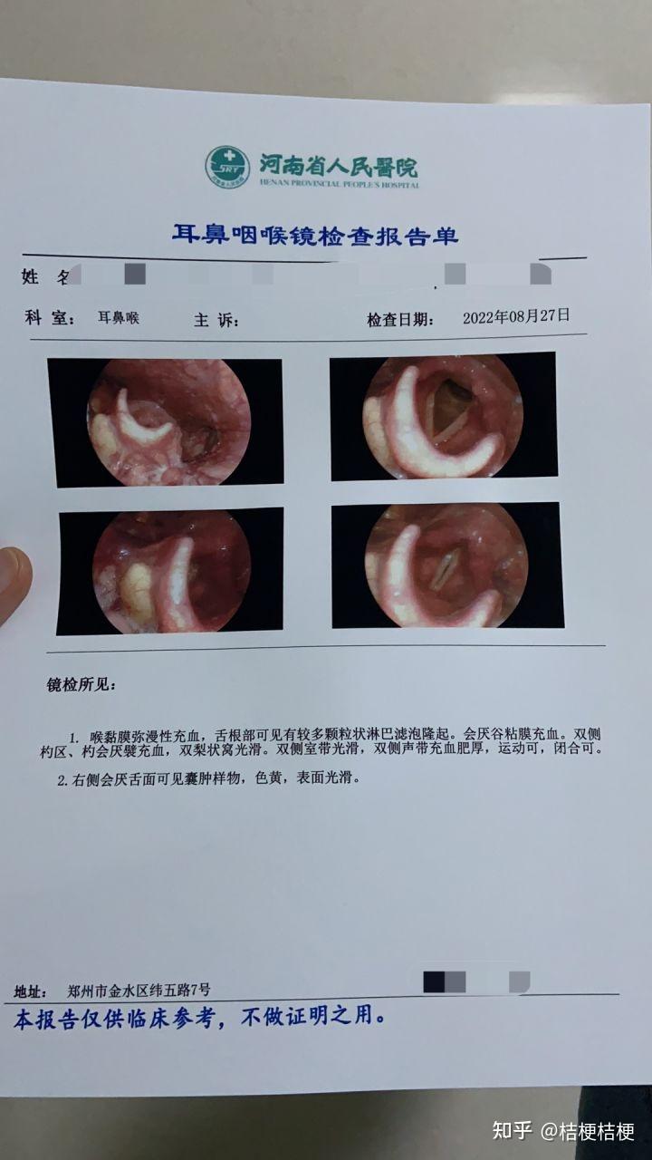 会厌囊肿手术多少钱图片