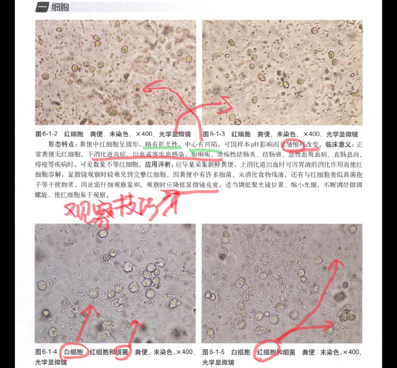 大便镜检红细胞图片