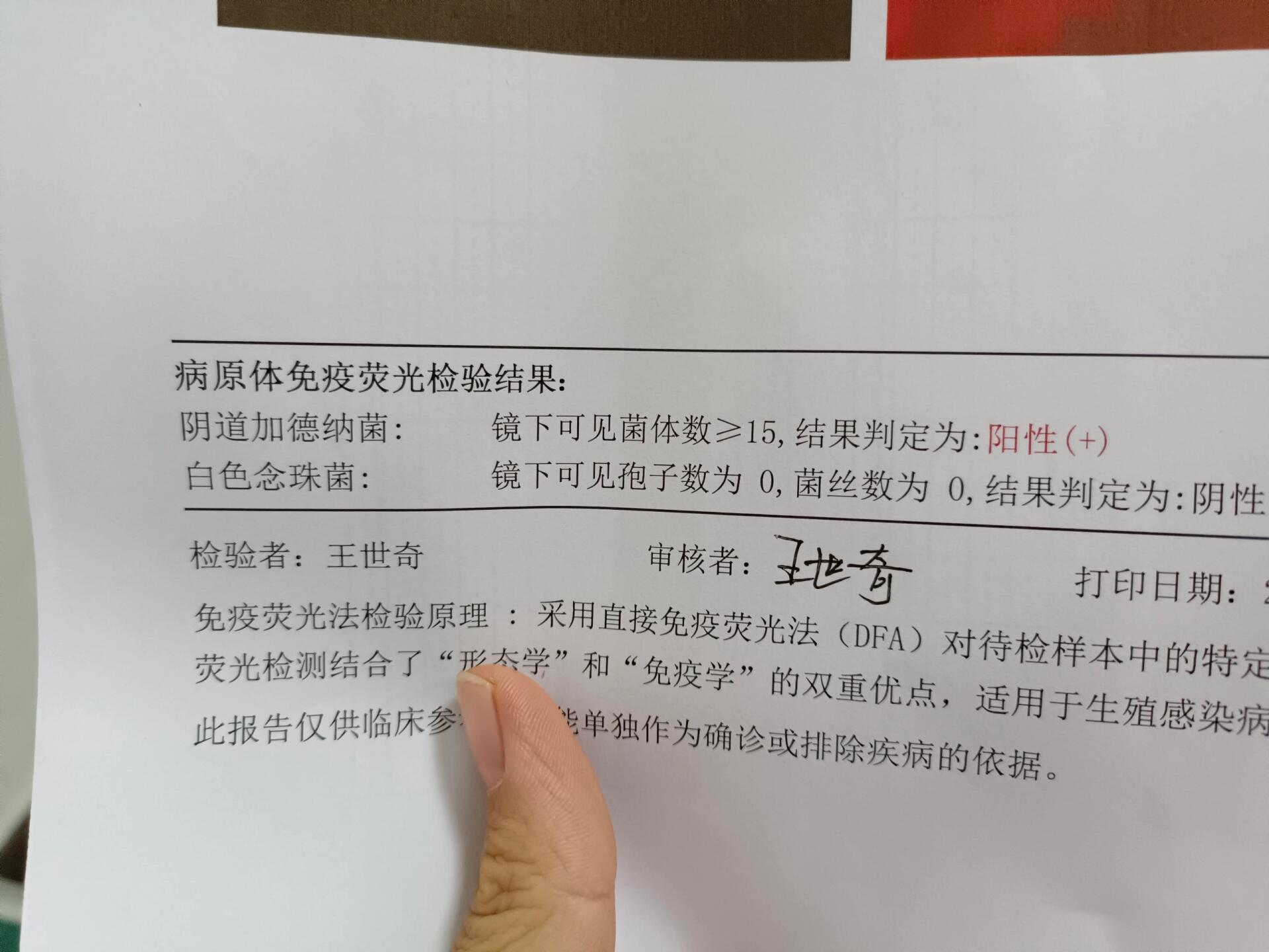 阴道加德纳菌是什么?