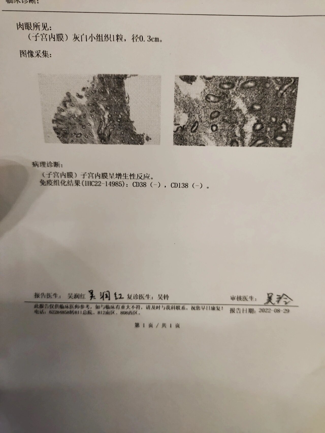 试管之宫腔镜(病理报告) 十点半到了分院等着取球囊,总院号挂在10.