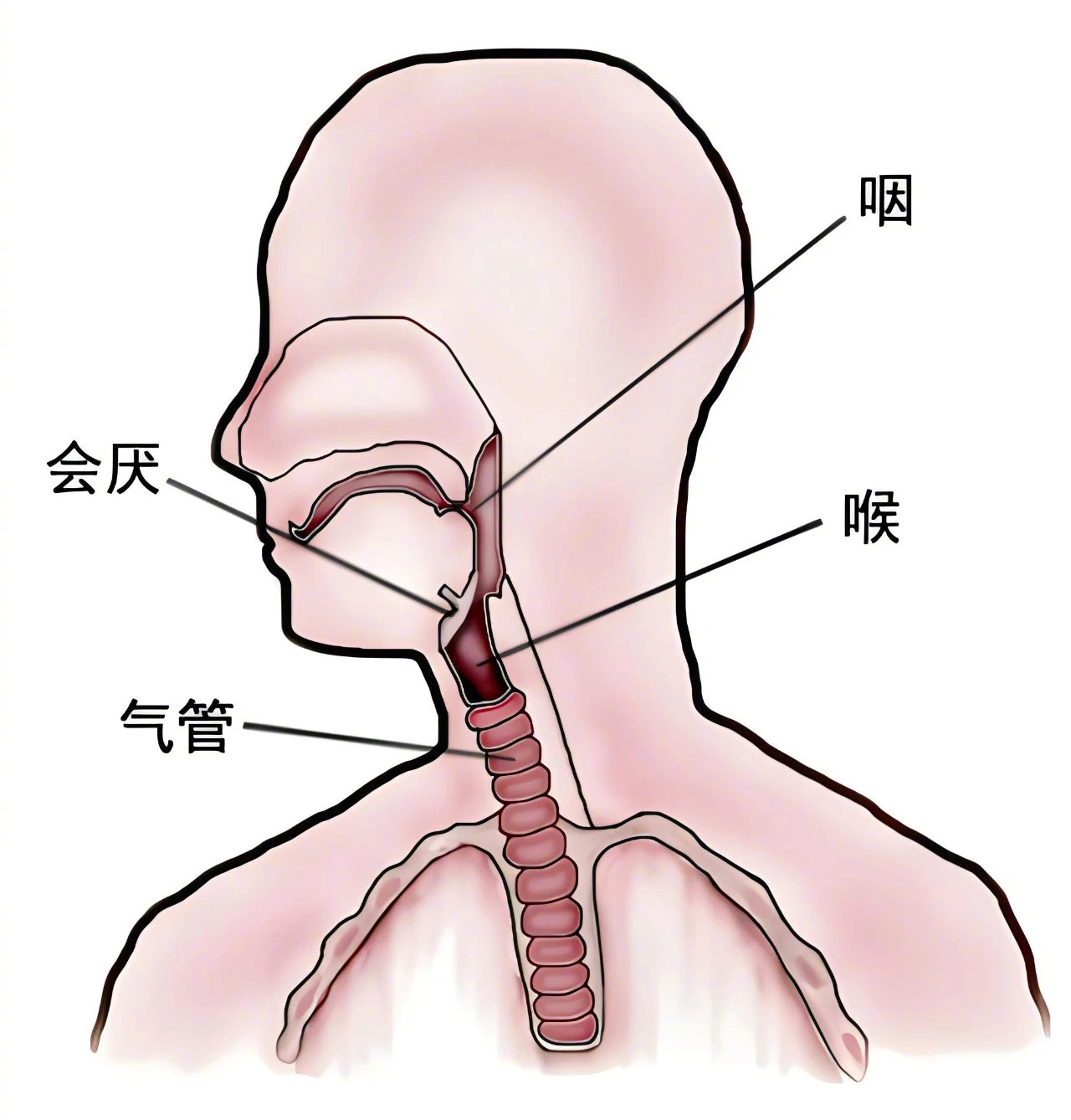 【#急性会厌炎与感冒咽喉痛的区别#】#急性会厌炎的喉咙痛会致命#天气