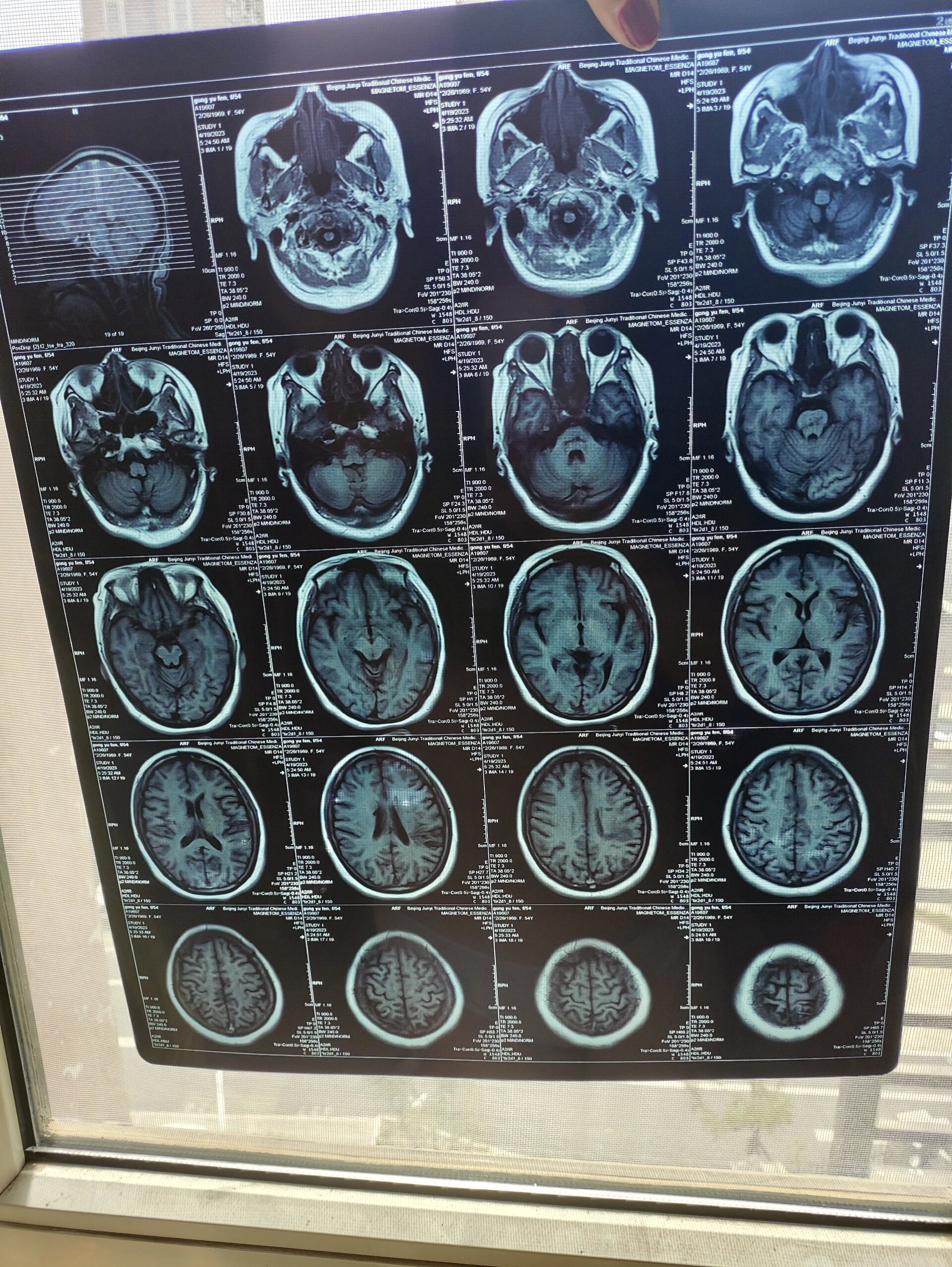 西苑医院核磁加急-西苑医院核磁加急核酸检测 西苑医院核磁加急-西苑医院核磁加急核酸检测