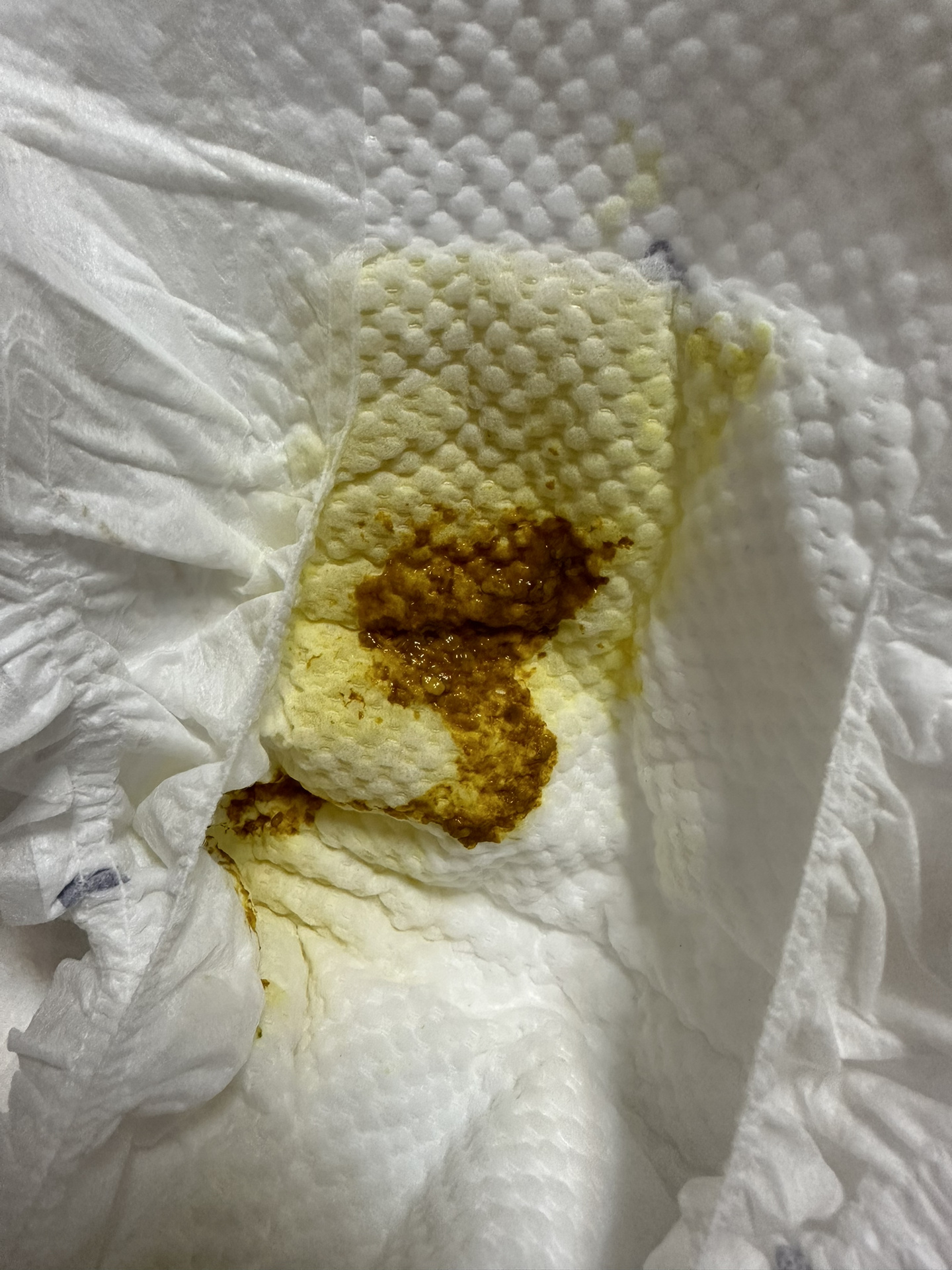 拉屎像拉水一样为什么