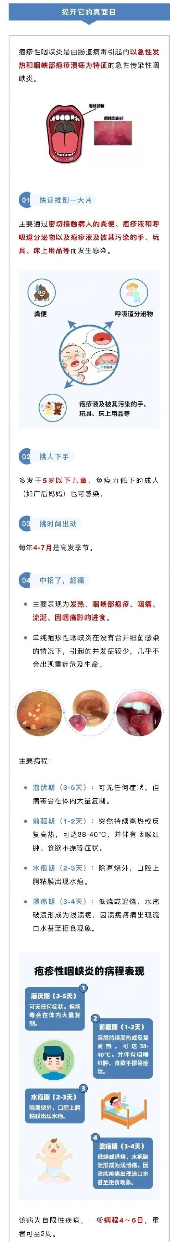 被自我耽误的一一疱疹性咽峡炎 近期,急性上呼吸道感染特别多,再加上