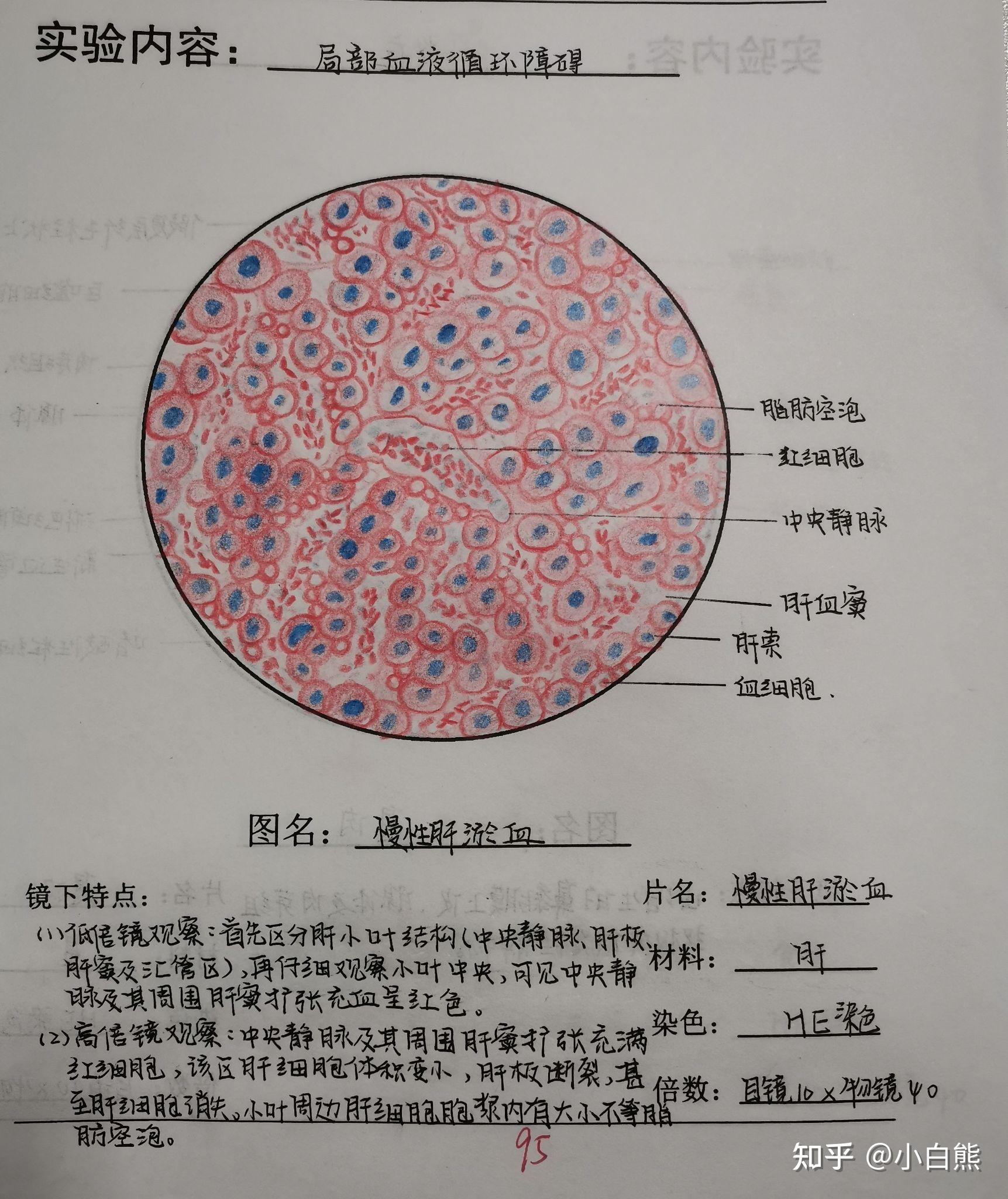 肝索镜下图片图片