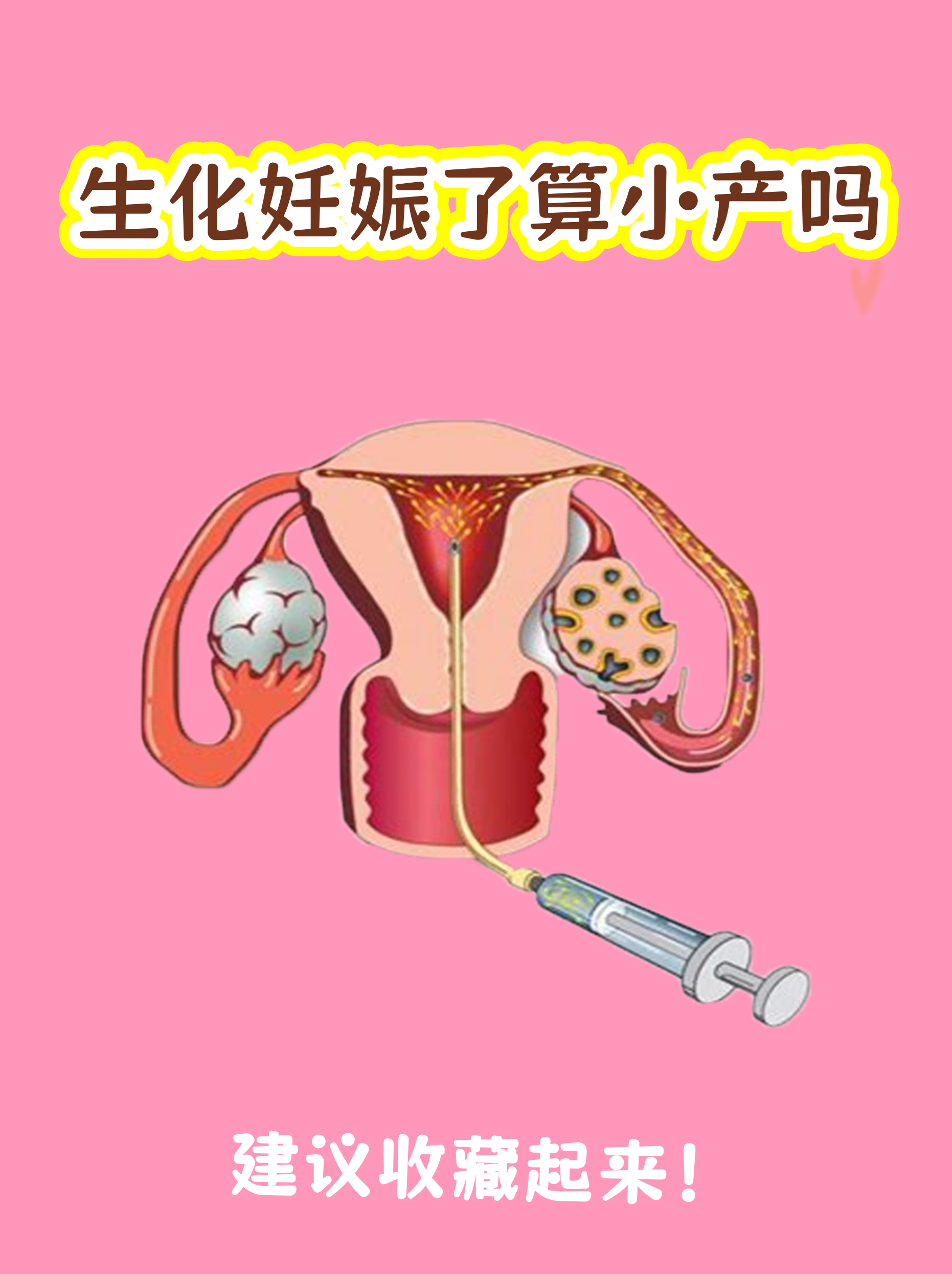 生化妊娠超度-生化妊娠能申请生育津贴吗