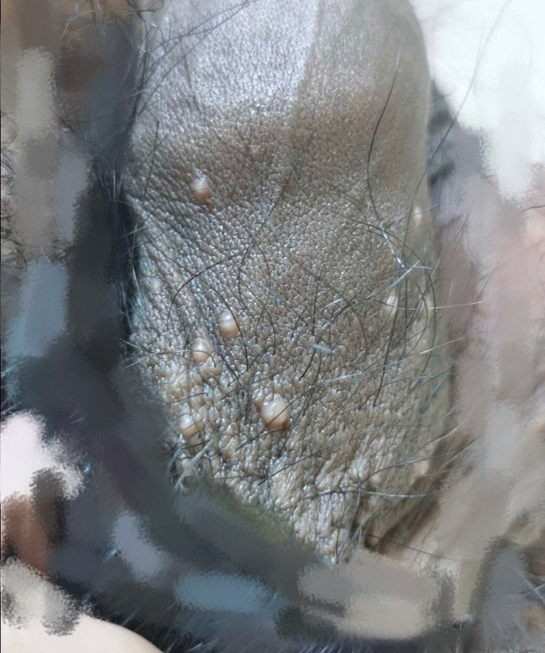 生物三个月了越来越多,不疼不痒怕是尖锐湿疣  图片表现是传染性软疣