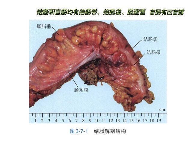 肠袢是什么图片