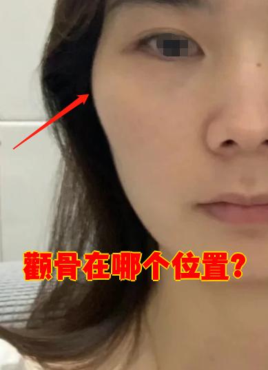 颧骨在哪个位置?