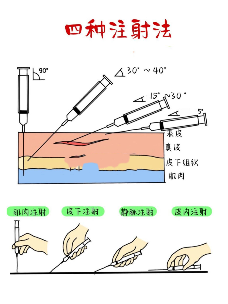 73基础护理学|46615种注射法97 97四种注射