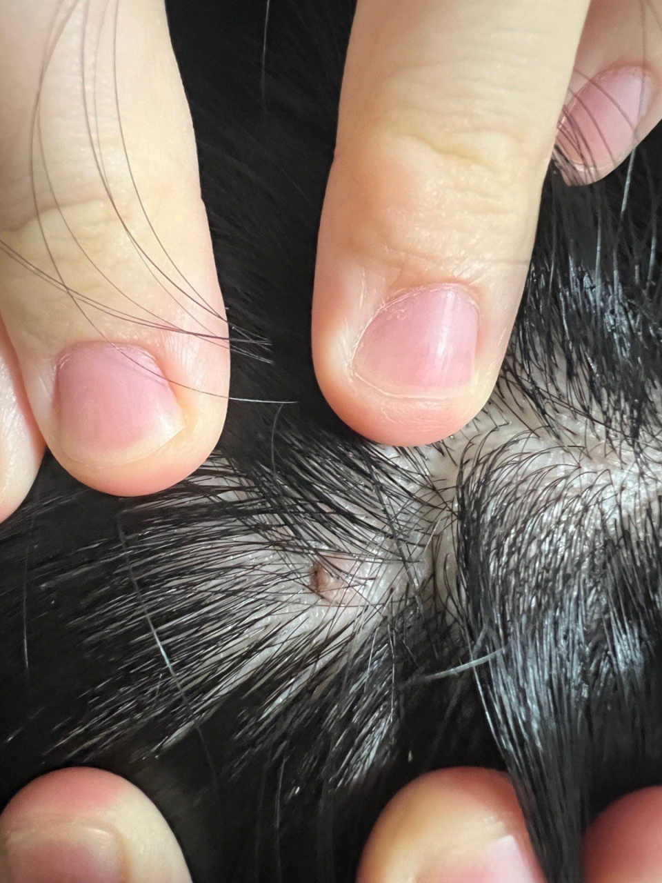 今晚吹头发的时候无意中摸到头上有一个小疙瘩,不痛不痒的.