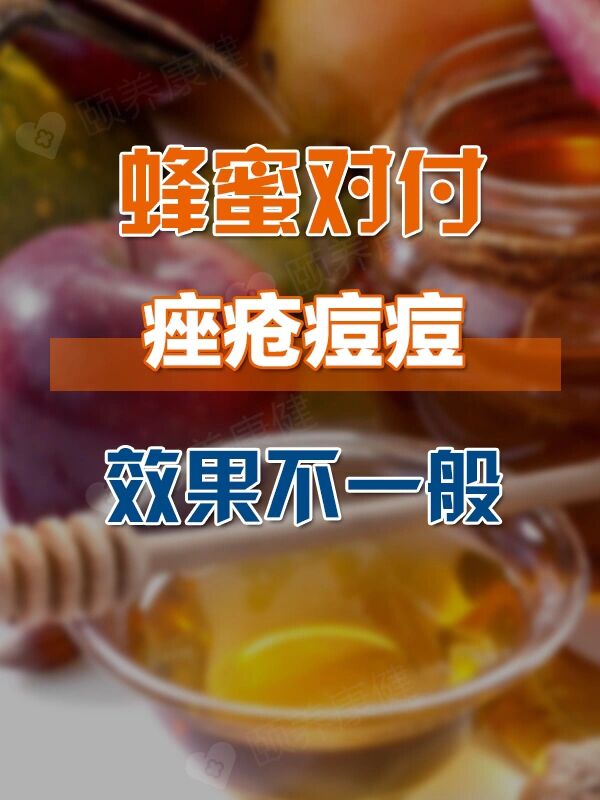 蜂蜜吃多了会不会长痘痘(蜂蜜吃多了会不会导致肥胖) 蜂蜜吃多了会不会长痘痘(蜂蜜吃多了会不会导致肥胖)
