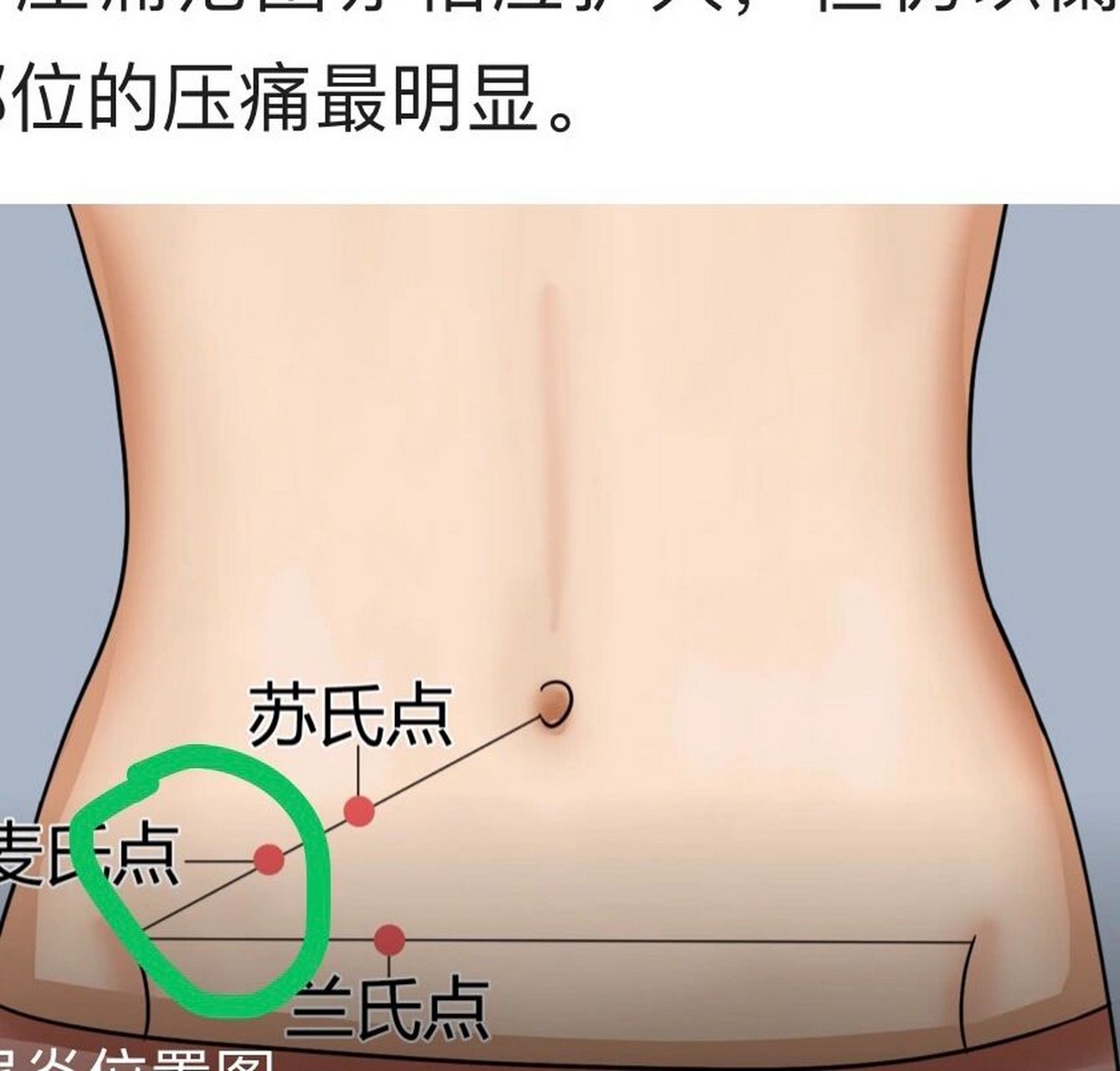 我开始在想,是不是宫外孕啊.