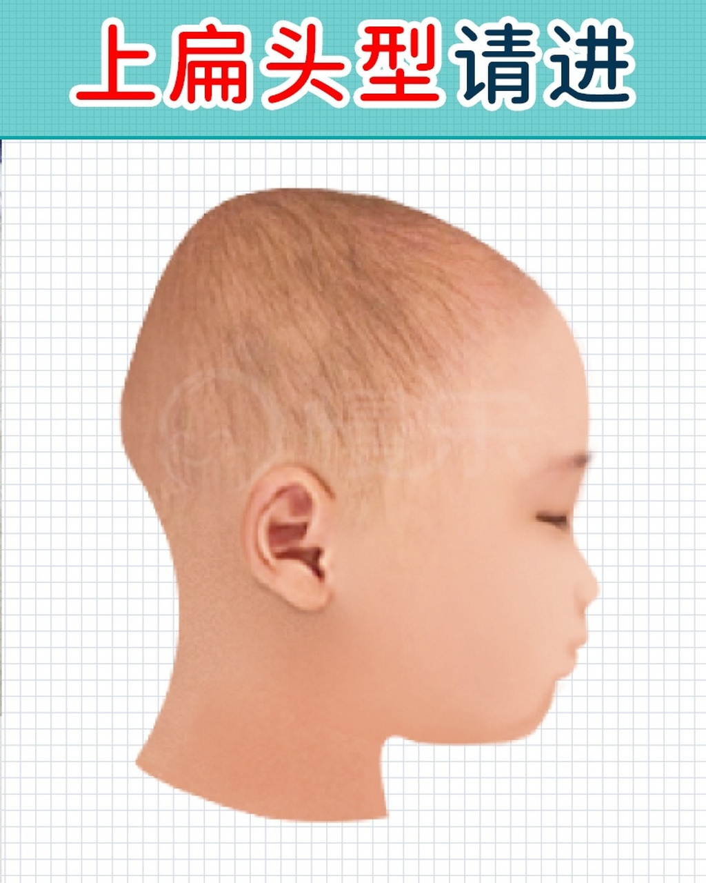 上扁头型没办法?