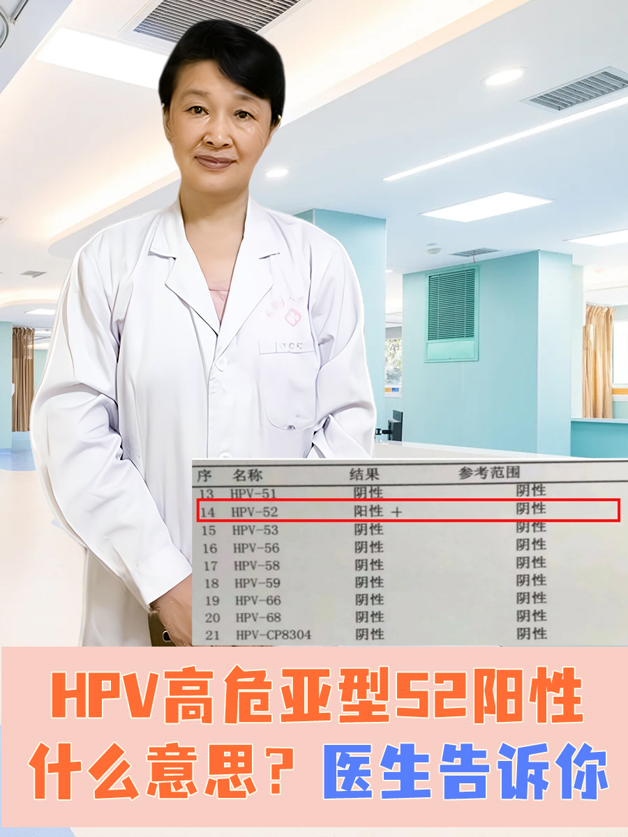 hpv高危亚型52阳性表示患者已经感染了人乳头瘤病毒(hpv)的高危型52