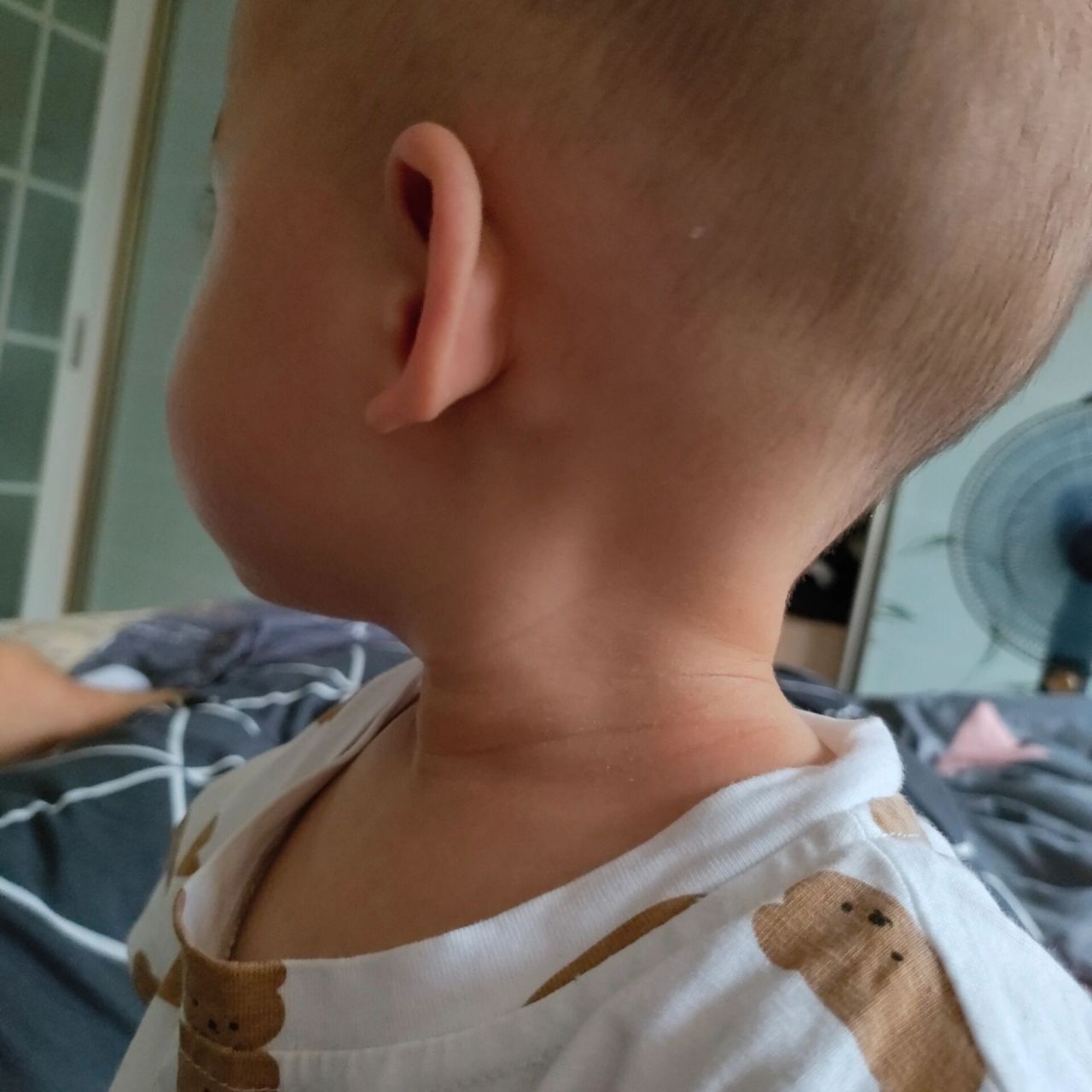 宝宝耳朵后面有个小鼓包原来是淋巴结 第一次当妈妈, 宝宝身上的点点