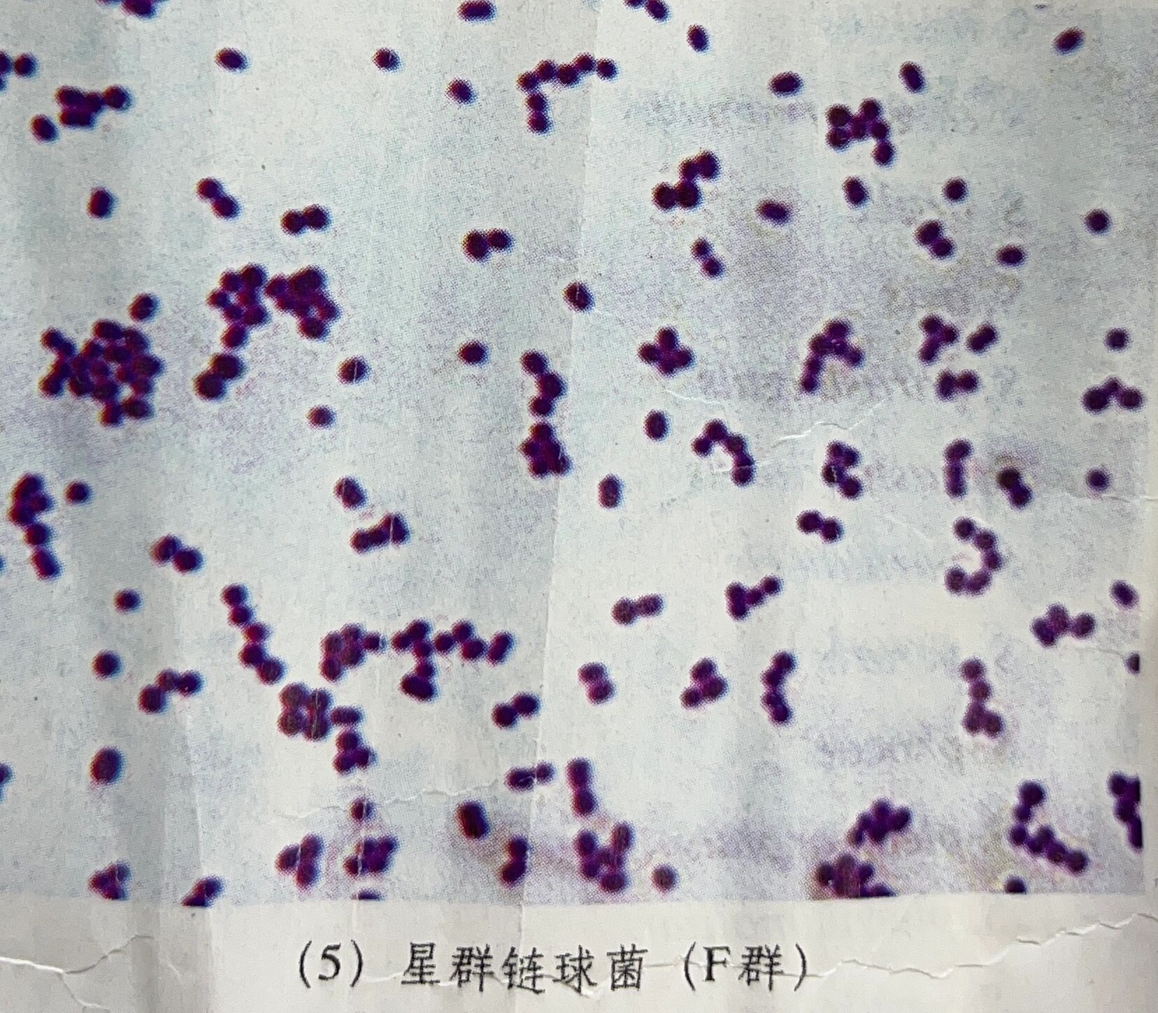 a群链球菌:菌落小,β溶血环直径宽