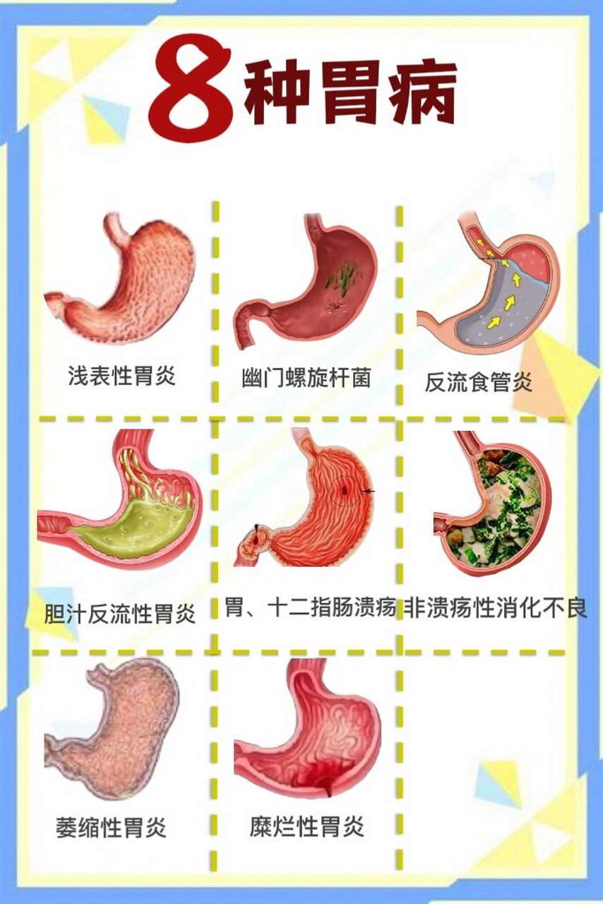 胃处于身体哪个位置图片