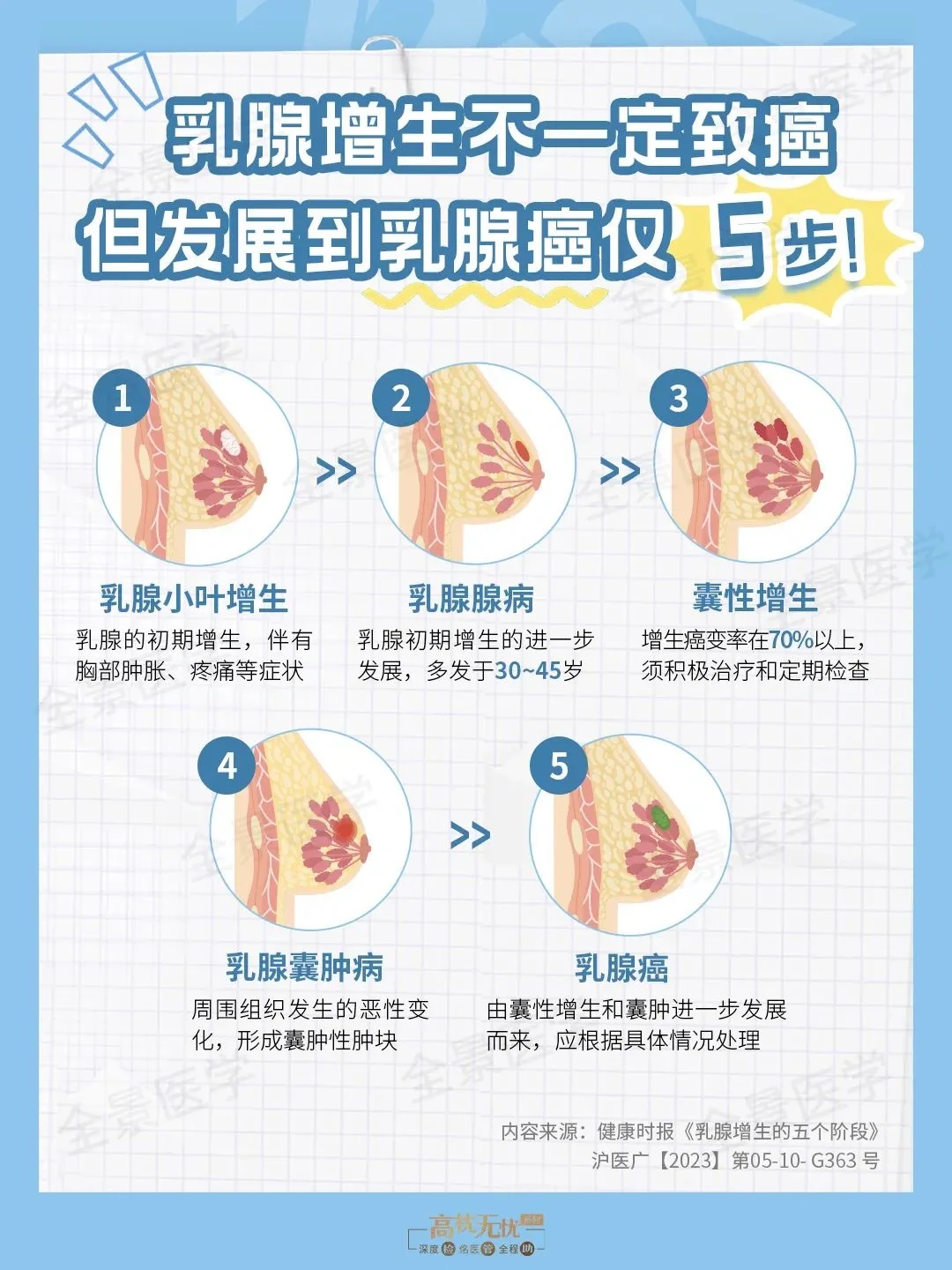 乳腺增生不一定致癌,但发展到乳腺癌仅5步!